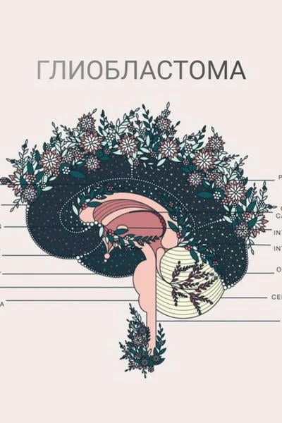 Глиобластома