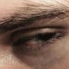 scar on your body