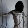 Anemia_0