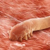 Demodex