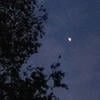 пипетка файлер